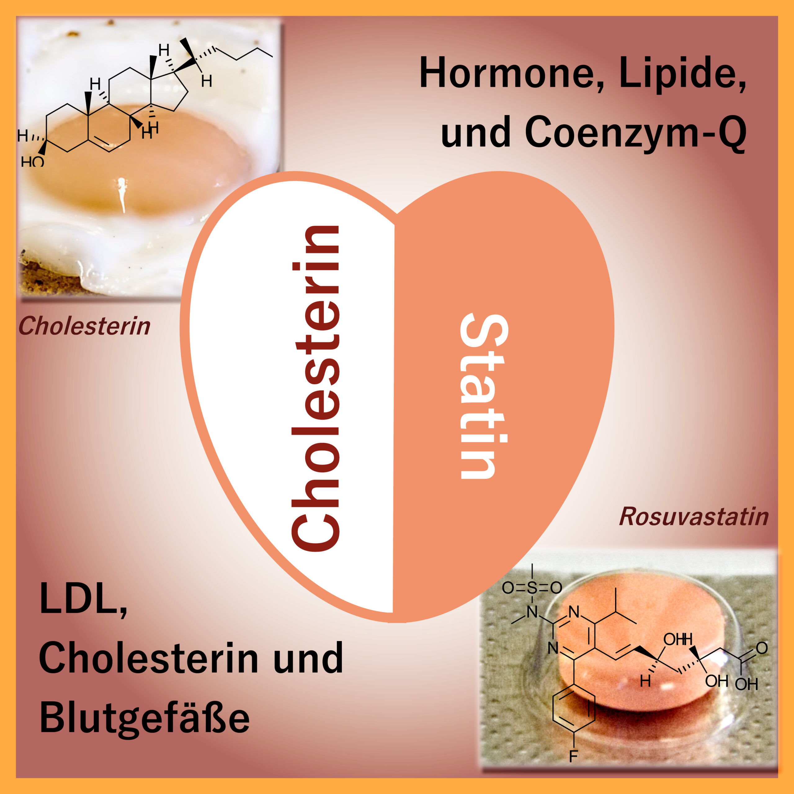 Cholesterin - Statine - Mechanismen und Wirkungen